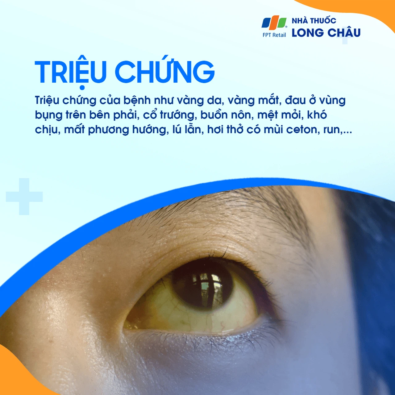 Suy Gan Cấp 2