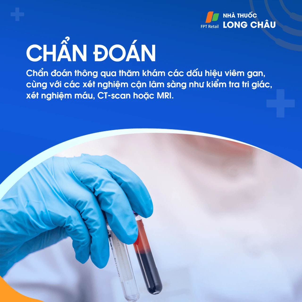 Suy Gan Cấp 5