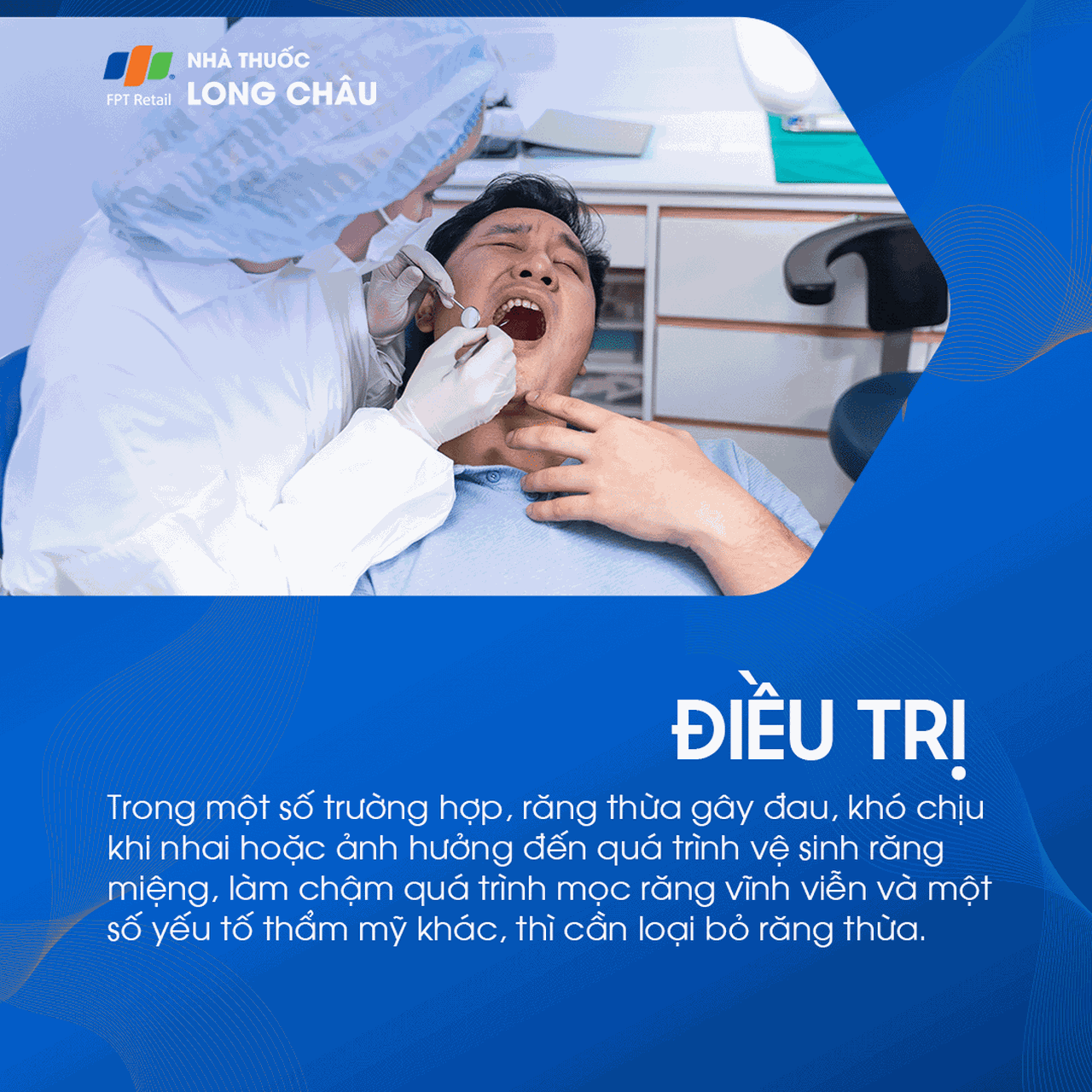 Răng thừa 6