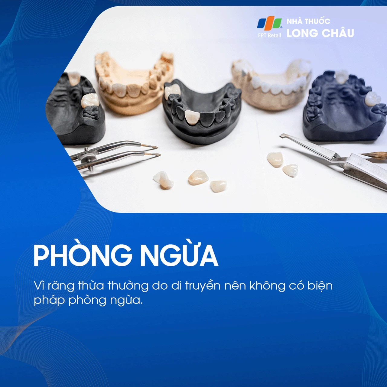 Răng thừa 7