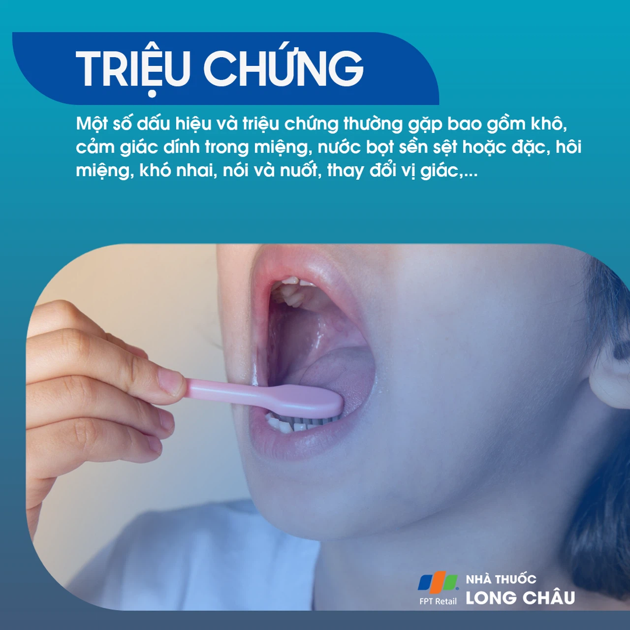 Khô miệng 2