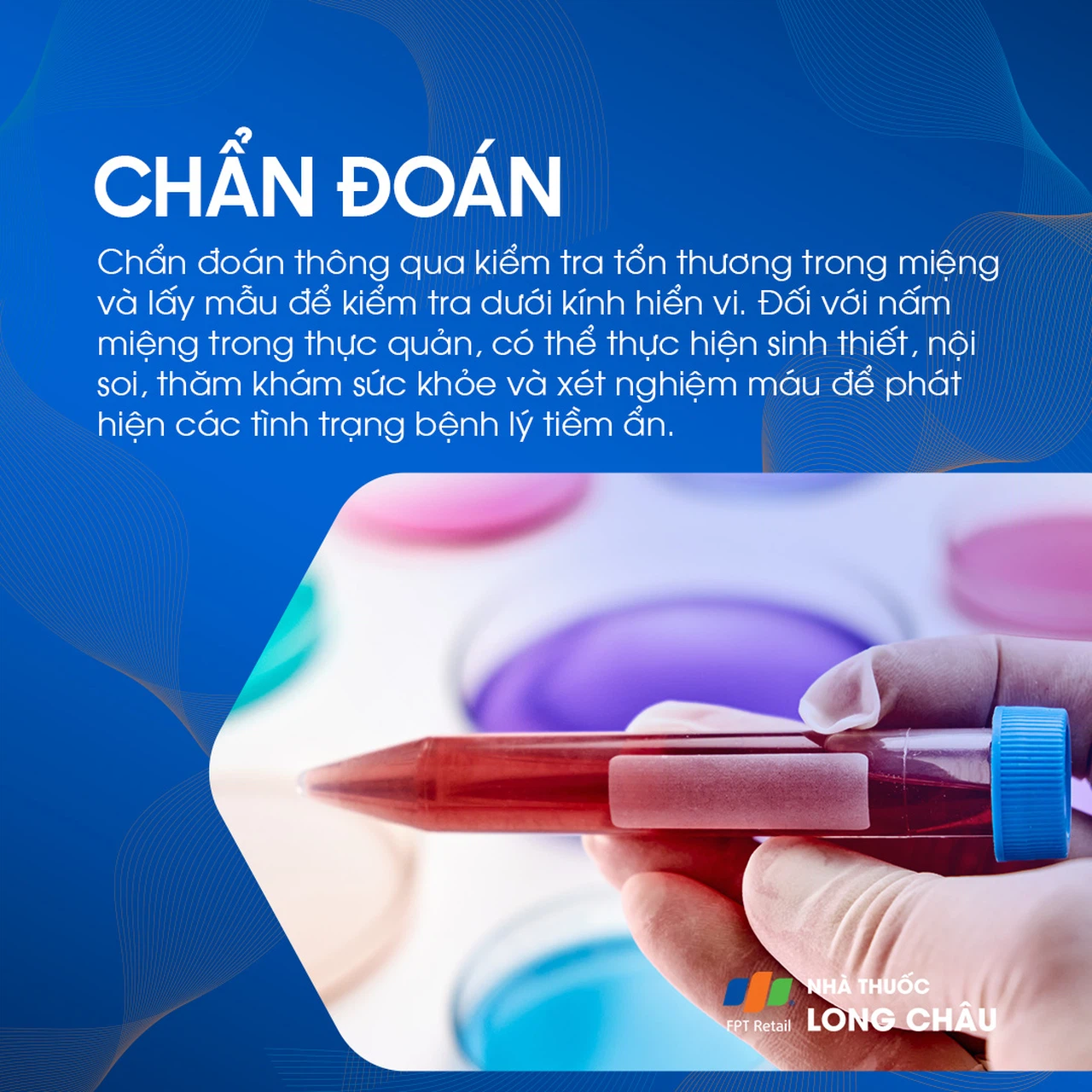 Nấm miệng 5