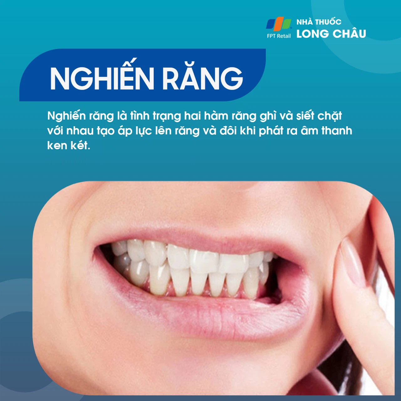 Nghiến răng 1