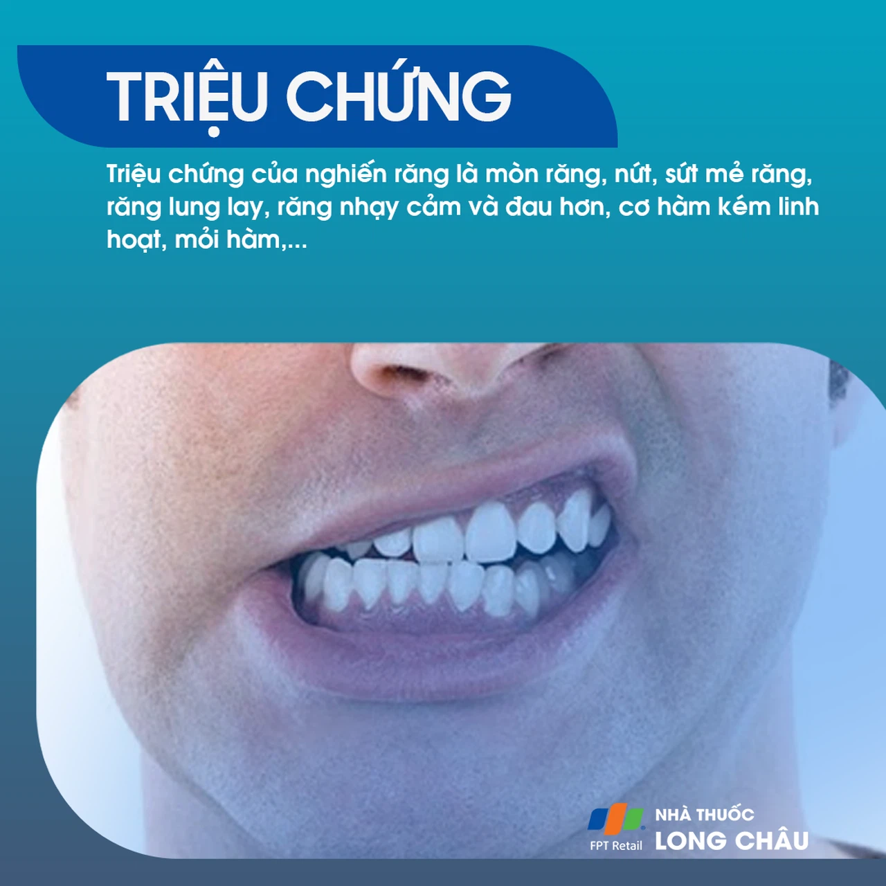Nghiến răng 2