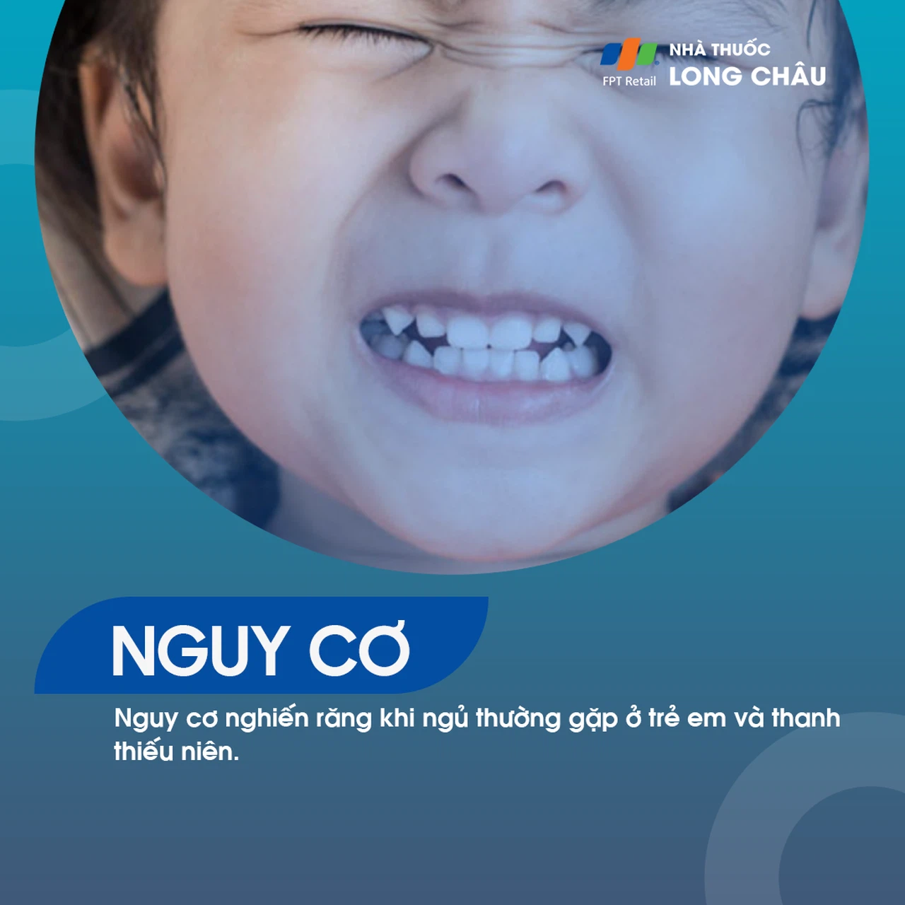 Nghiến răng 4