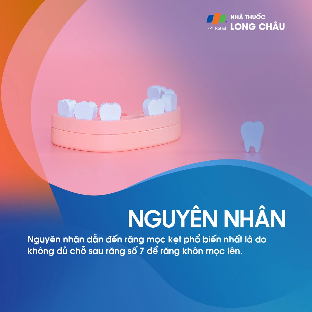 Răng mọc kẹt 3