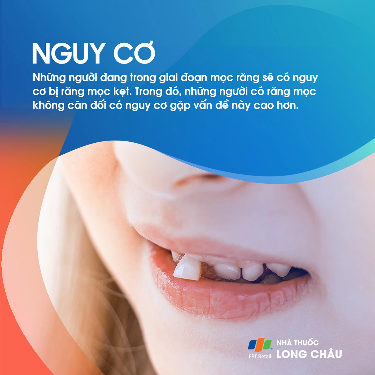 Răng mọc kẹt 4