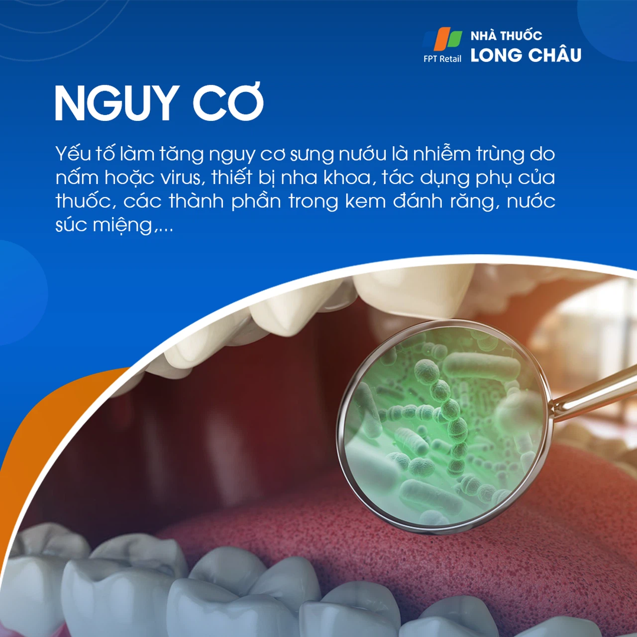 Sưng nướu 4