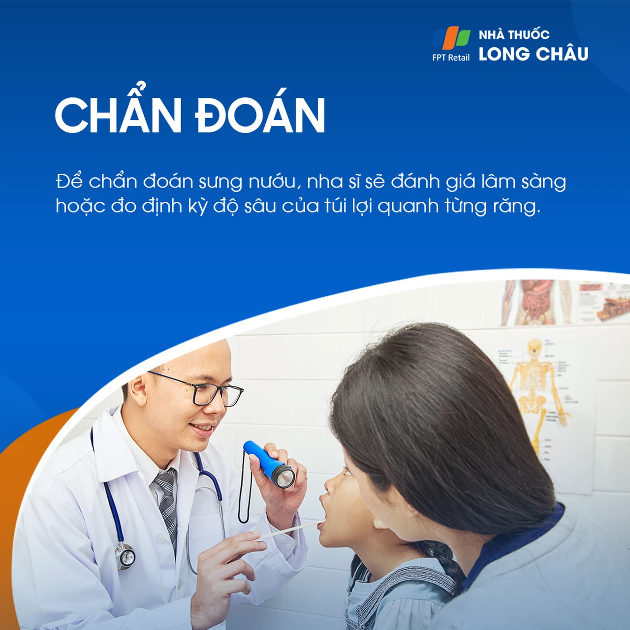 Sưng nướu 5