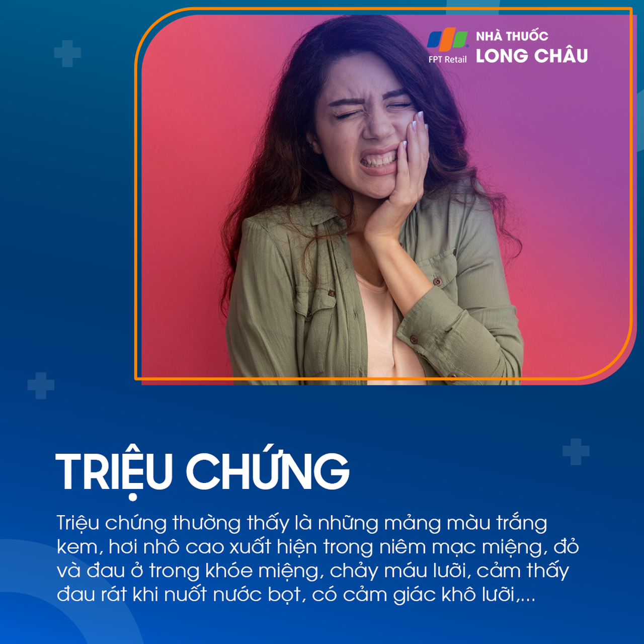 Tưa miệng 2