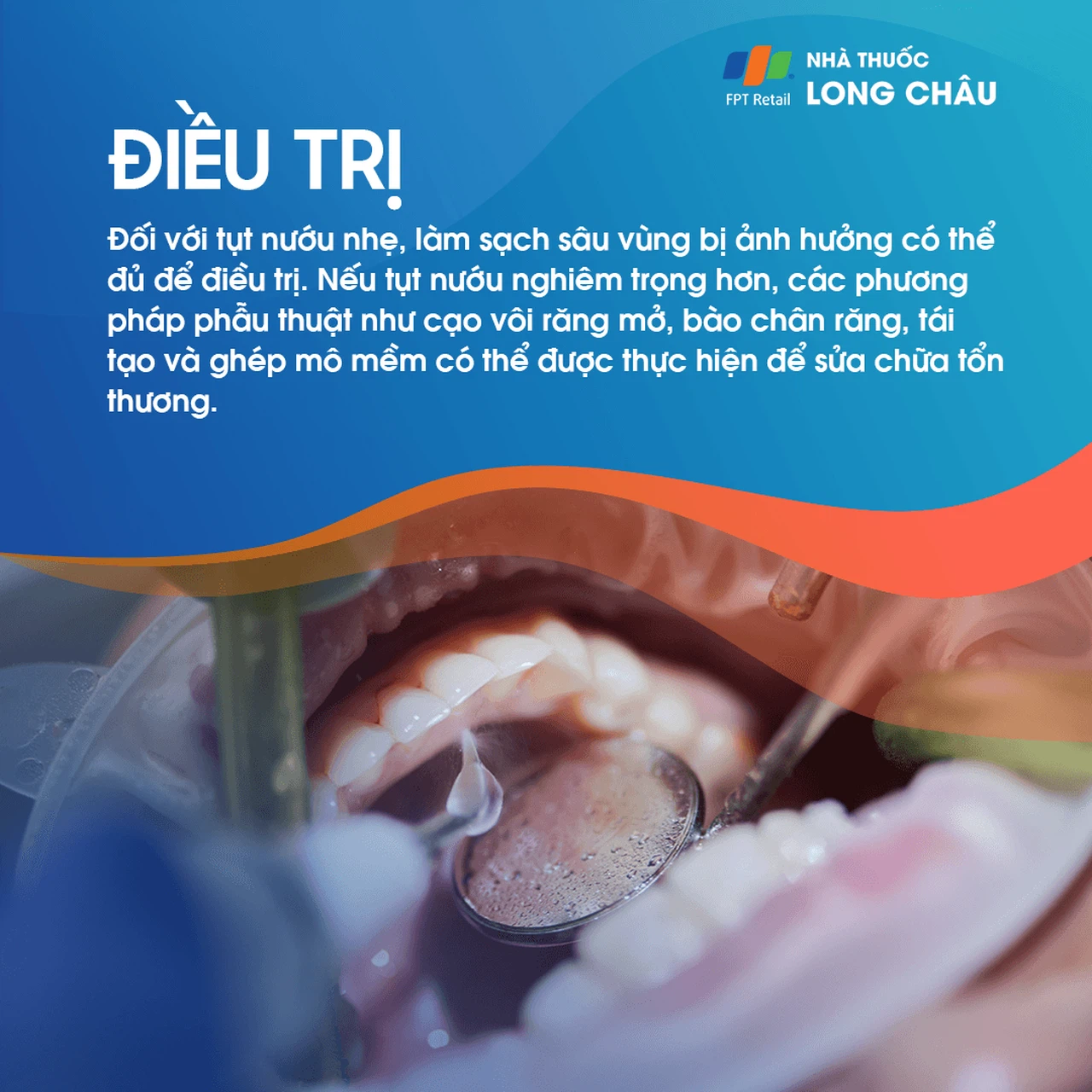 Tụt lợi 6