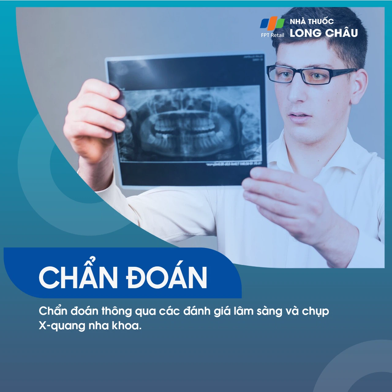 Viêm chân răng 5