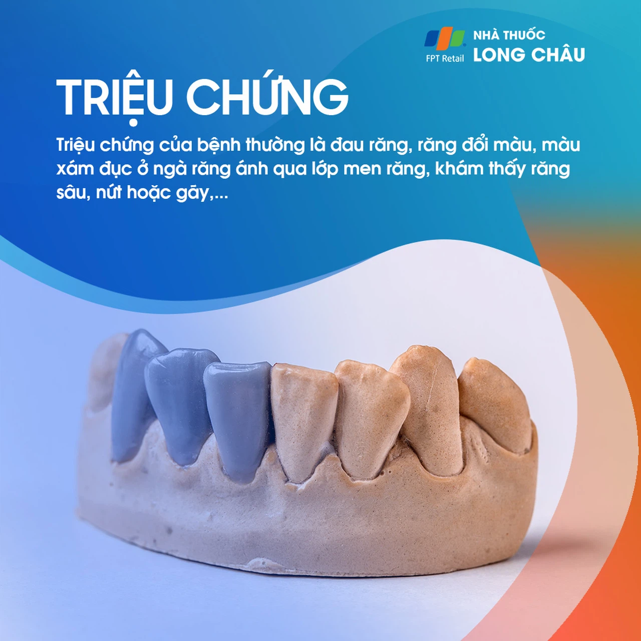 Viêm tủy răng 2