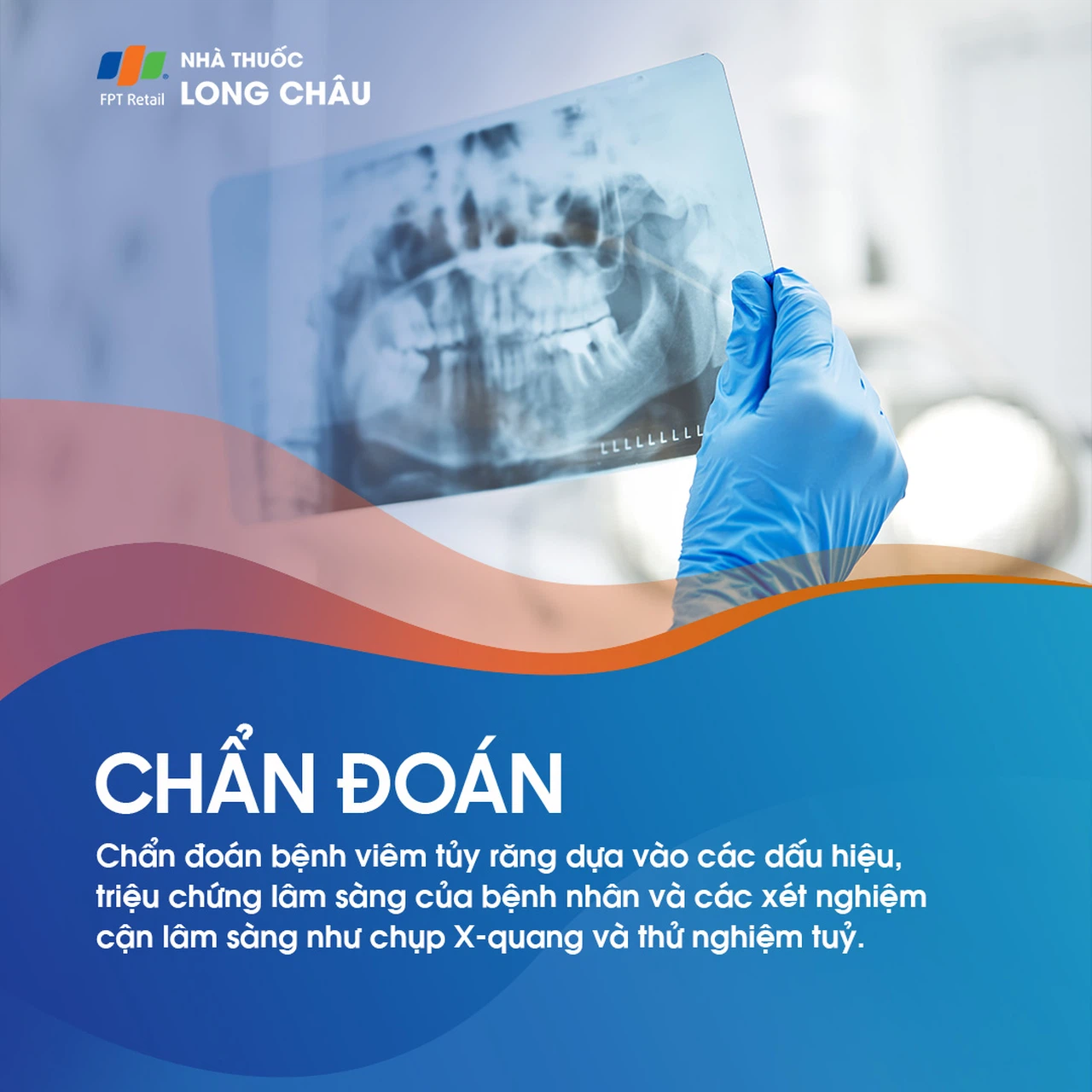 Viêm tủy răng 5
