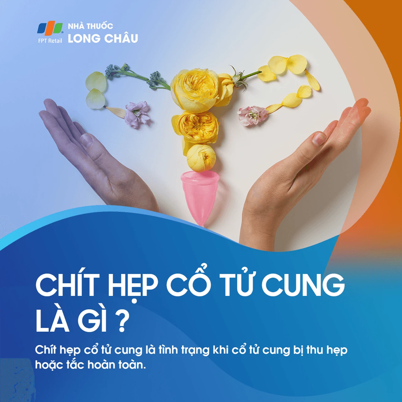 Chít hẹp cổ tử cung 1