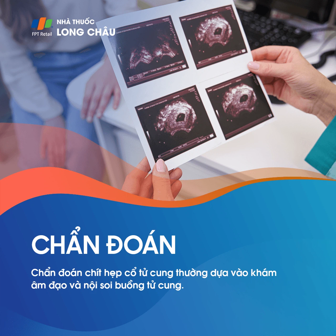 Chít hẹp cổ tử cung 5