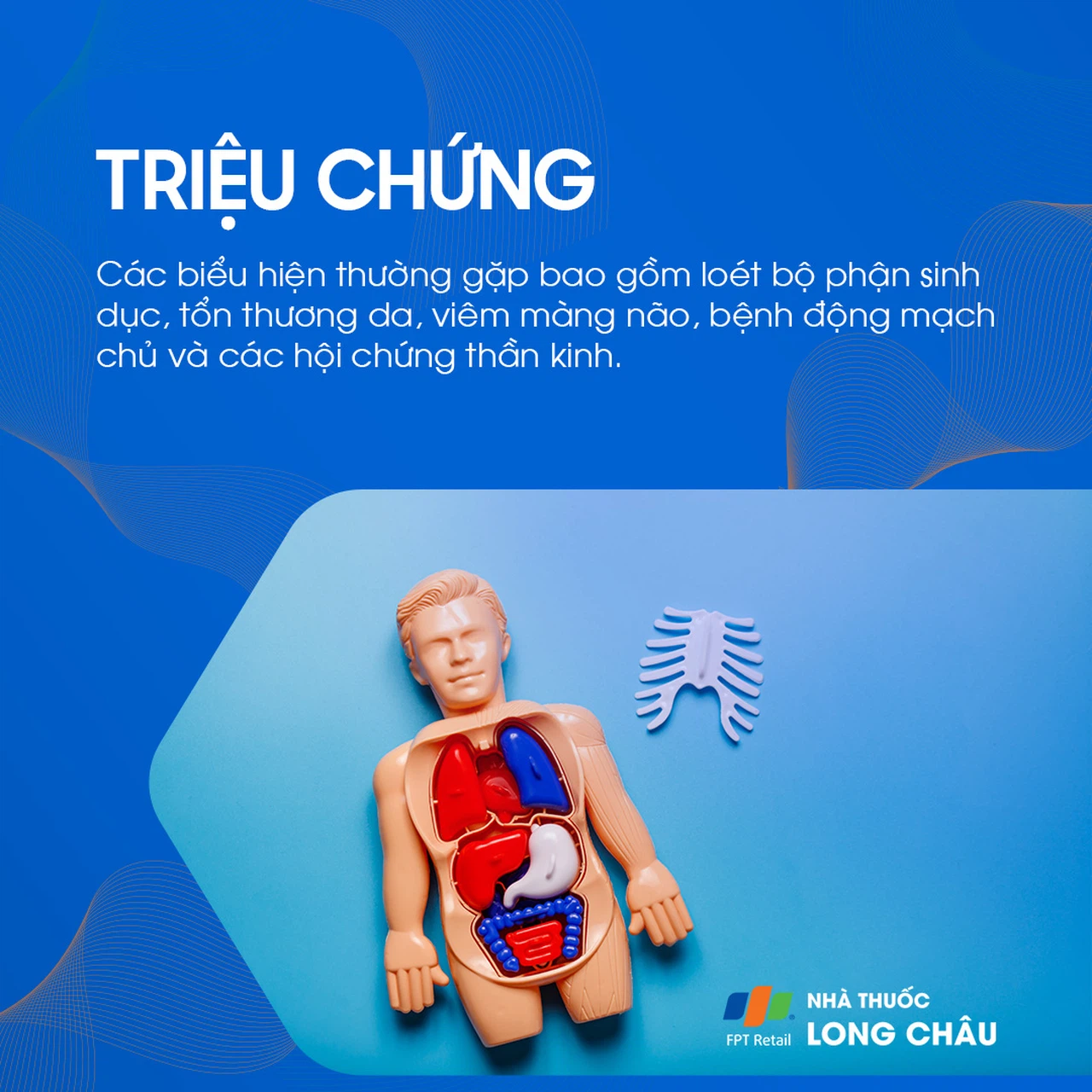 Giang mai 2