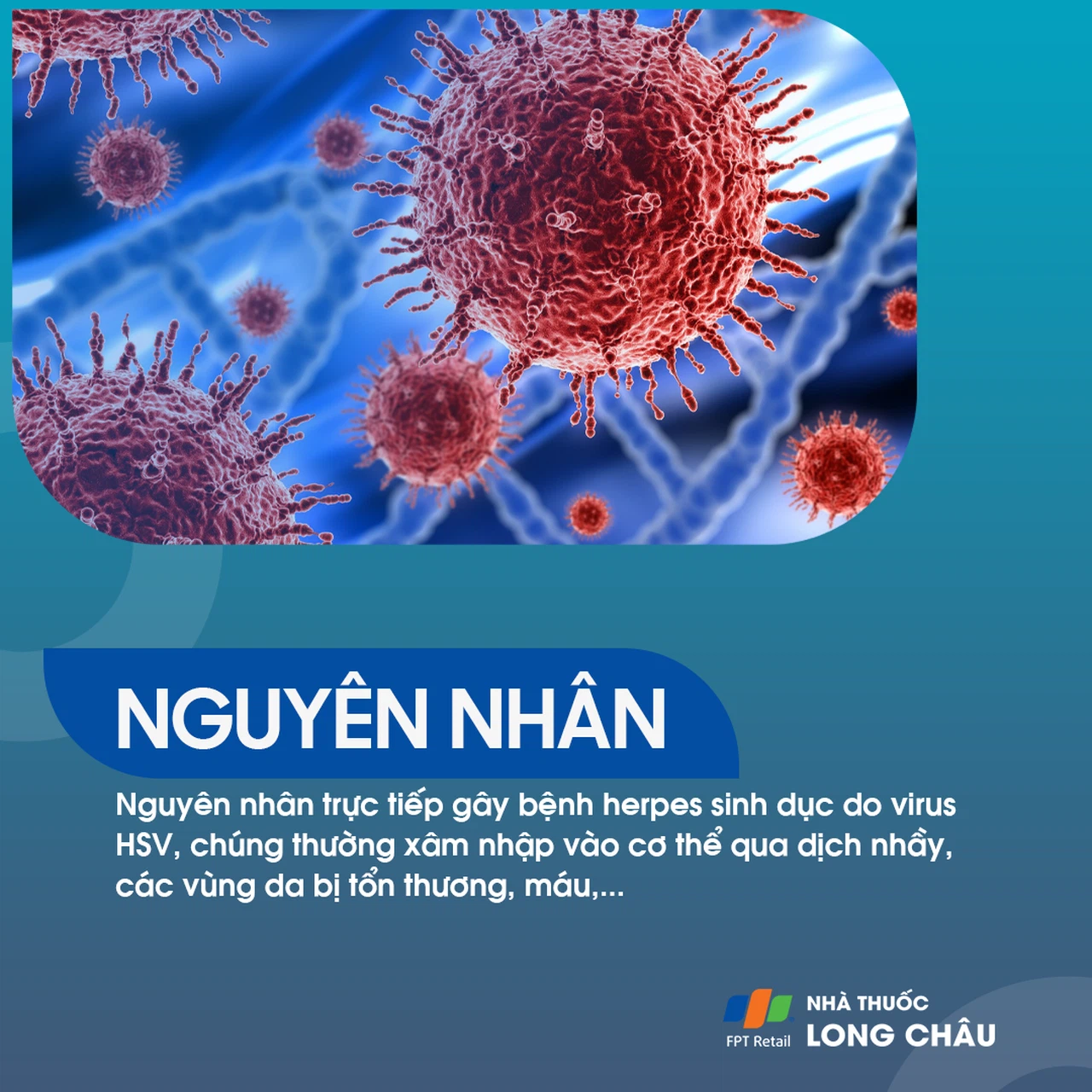 Herpes sinh dục 4