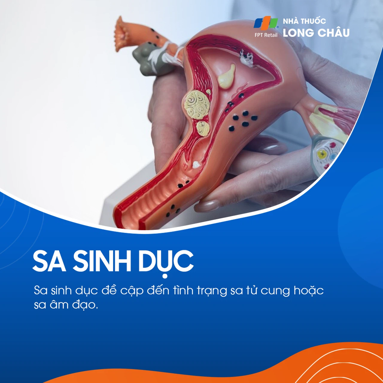 Sa sinh dục 1