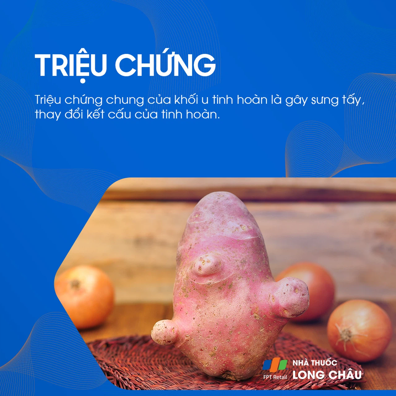 U tinh hoàn 2