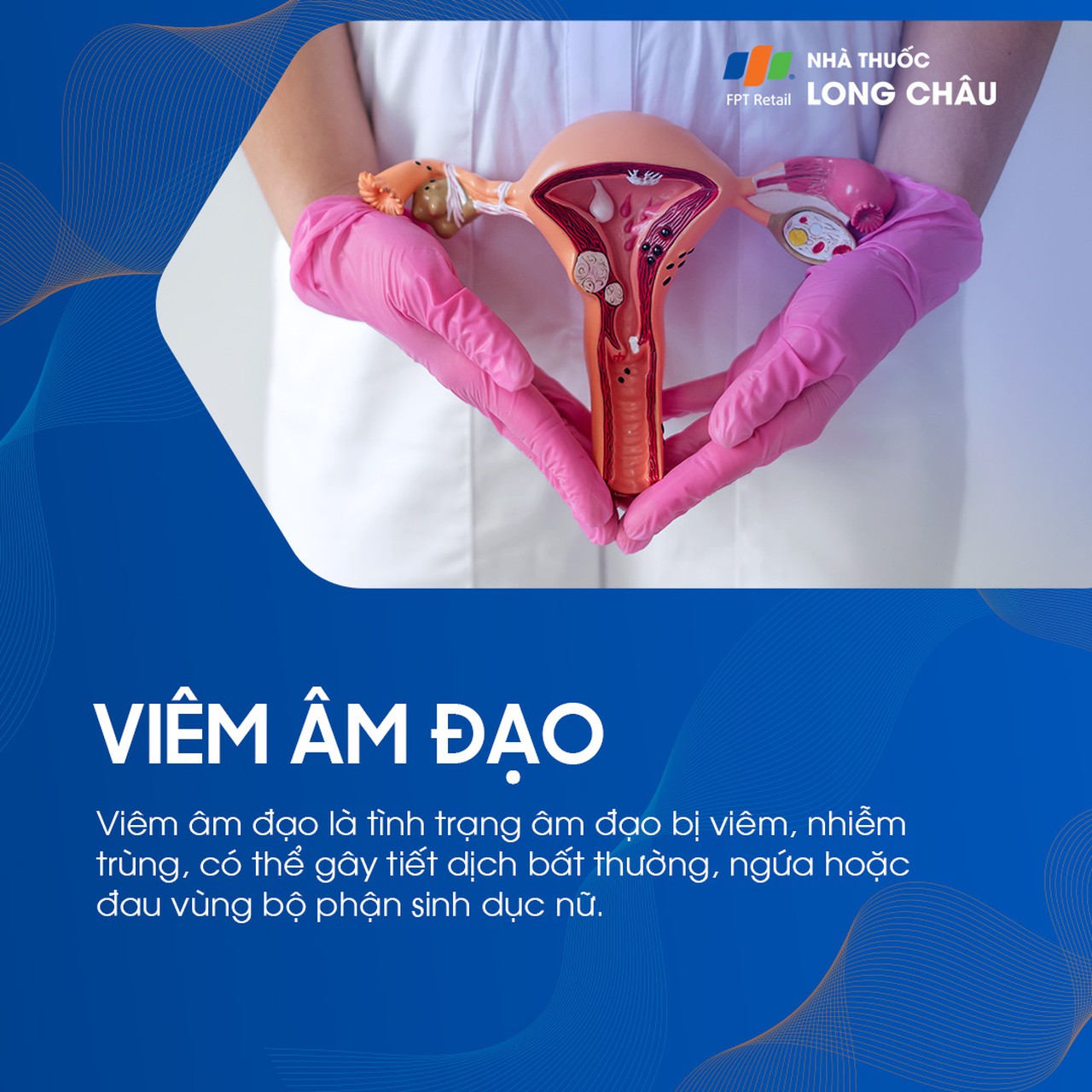 Viêm âm đạo 1
