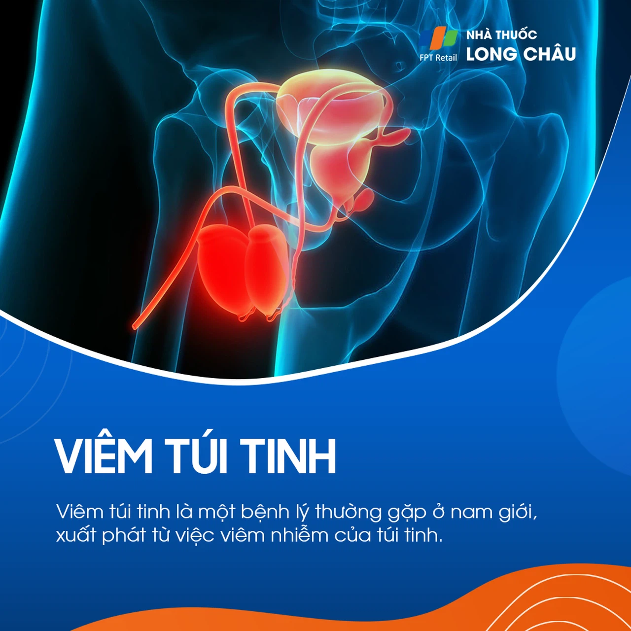 Viêm túi tinh 1