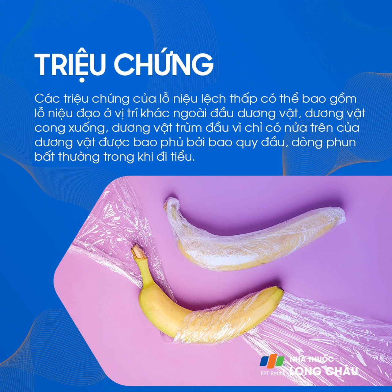 Lỗ tiểu lệch thấp 2