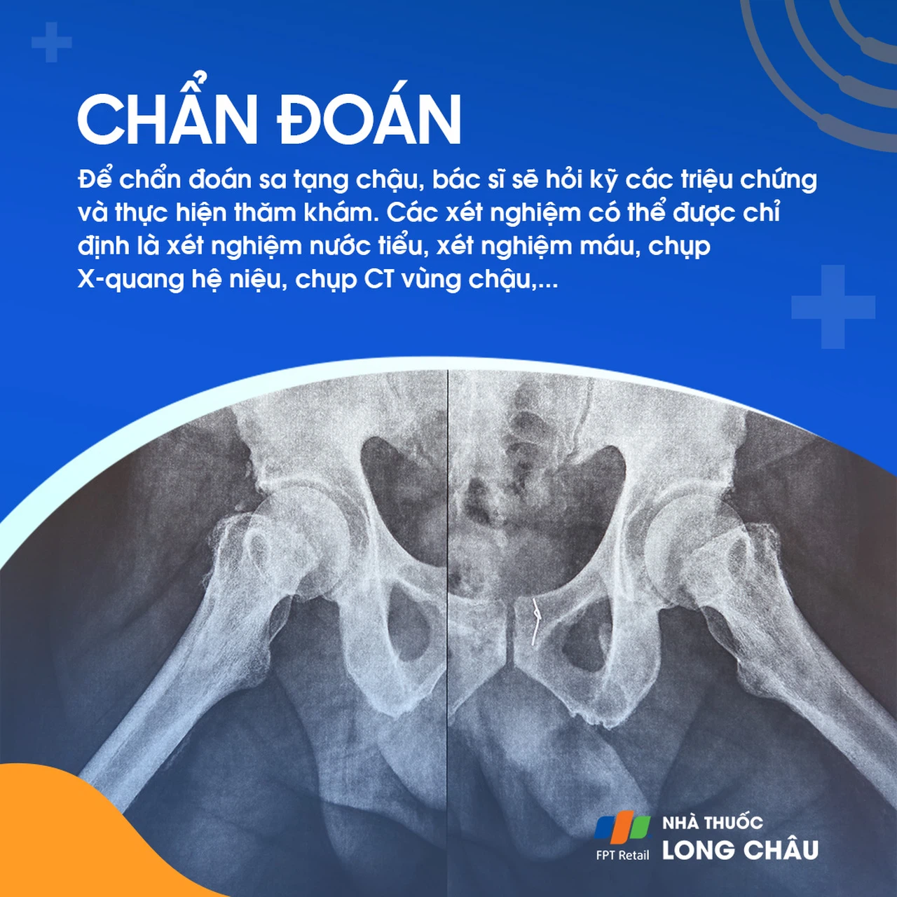 Sa tạng chậu 5