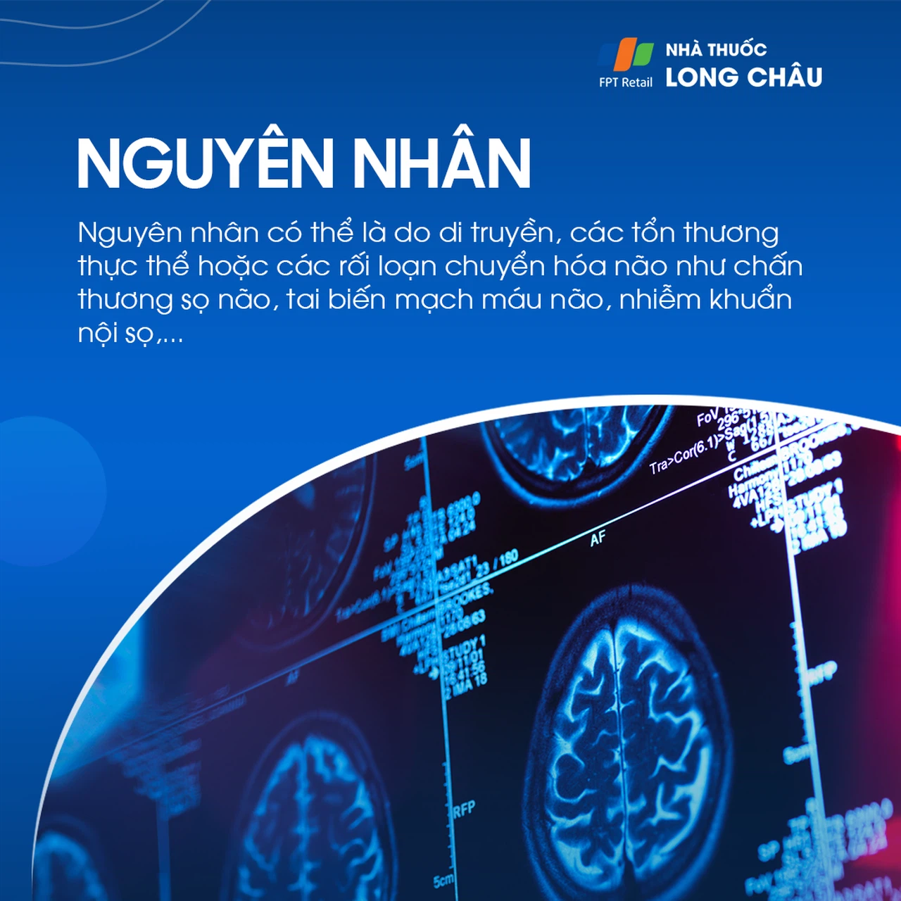 Động kinh 5