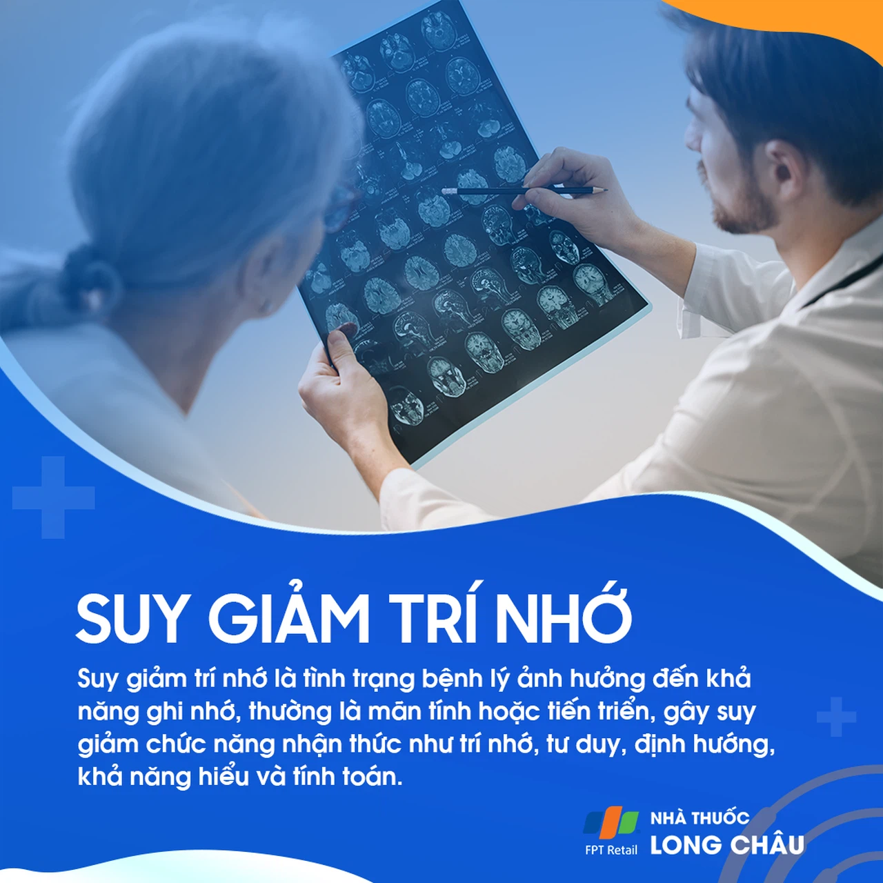 Suy giảm trí nhớ 1