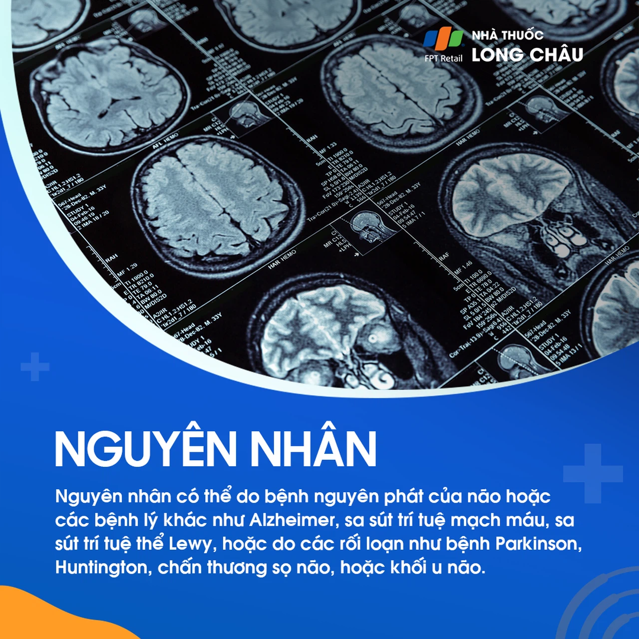 Suy giảm trí nhớ 5