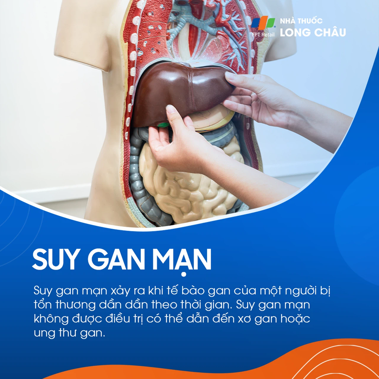 Suy gan mạn 1