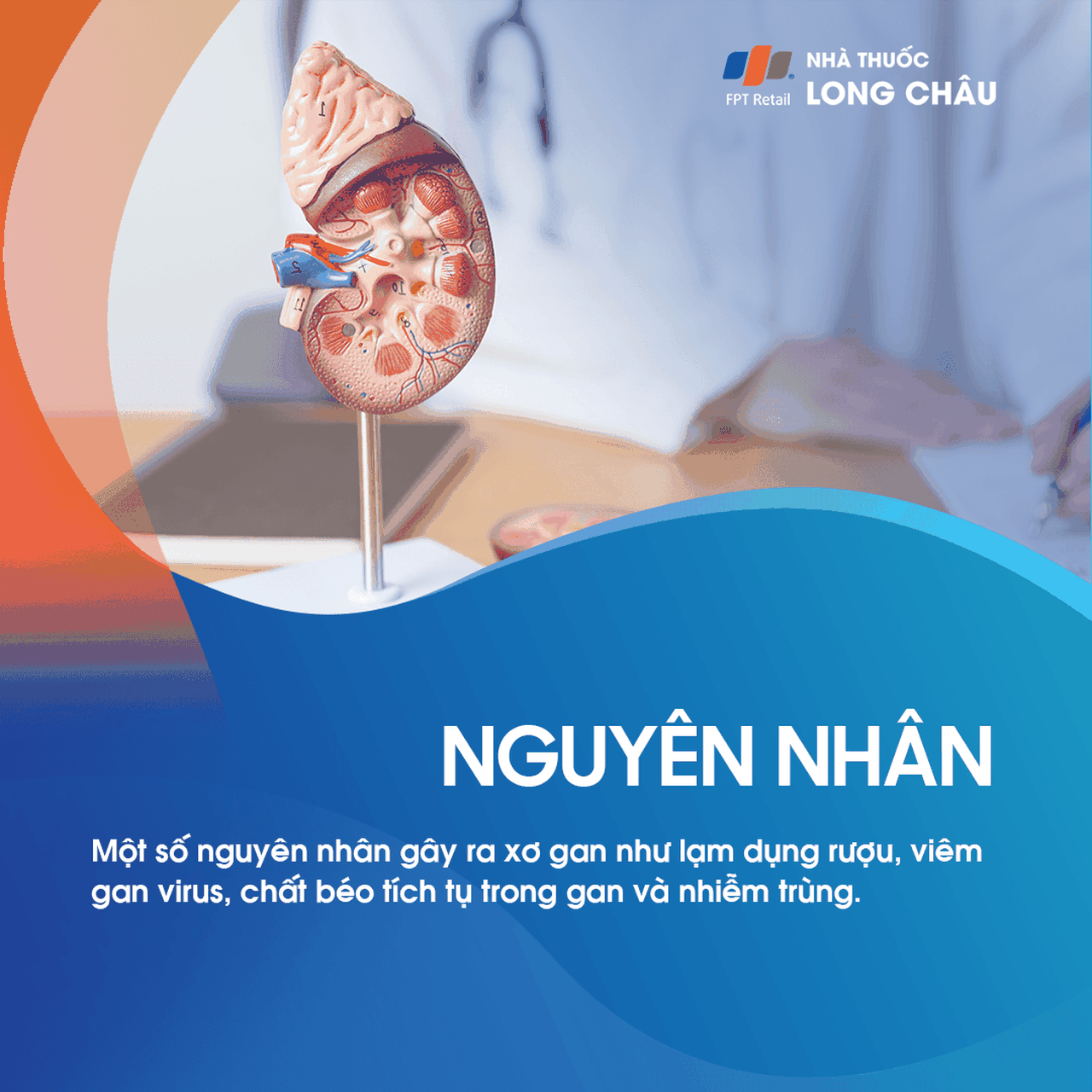 Nguyên nhân xơ gan - Các yếu tố gây tổn thương gan