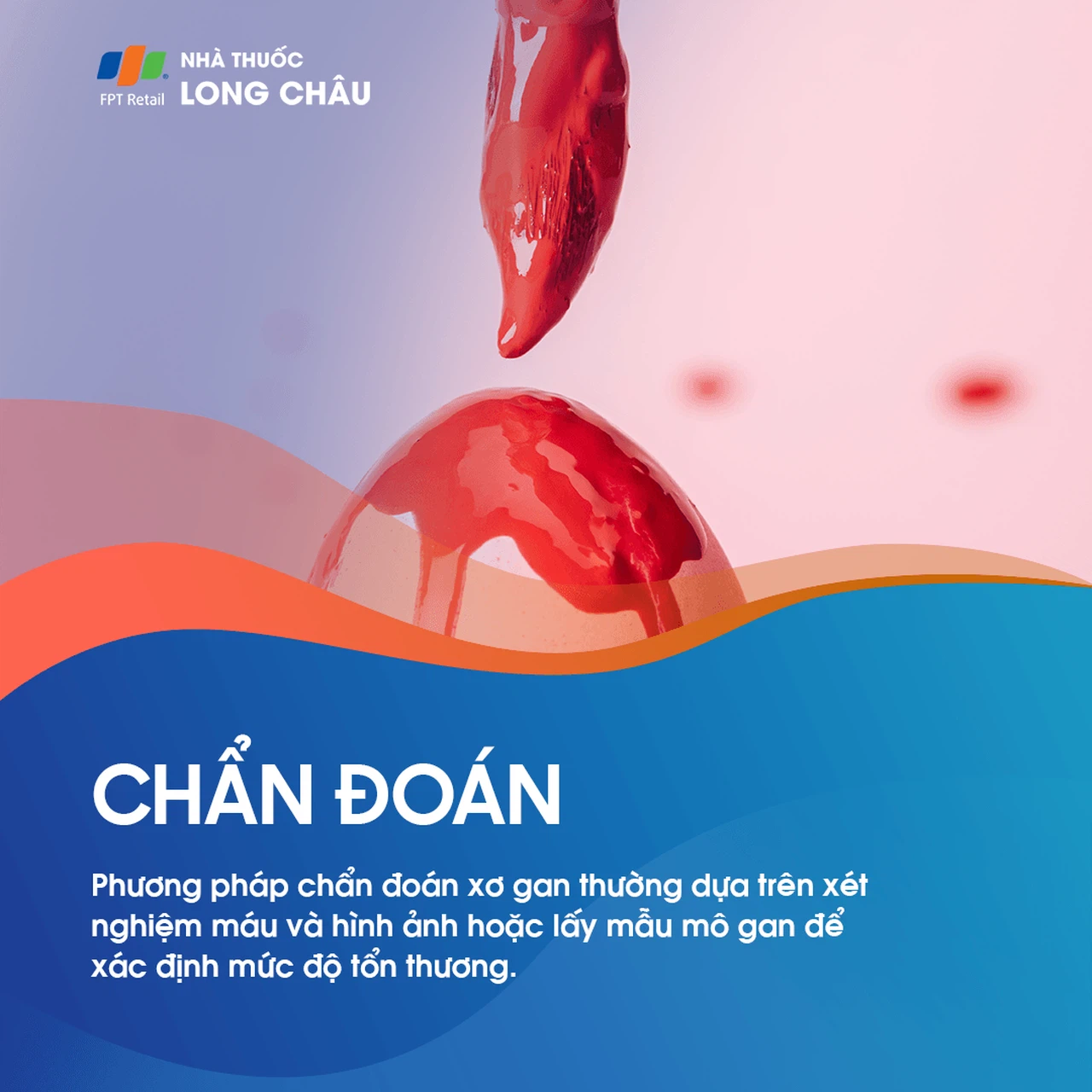 Chẩn đoán xơ gan - Quy trình kiểm tra và xác định tình trạng xơ gan