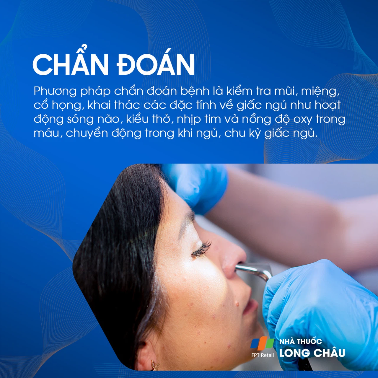 Ngáy ngủ 5