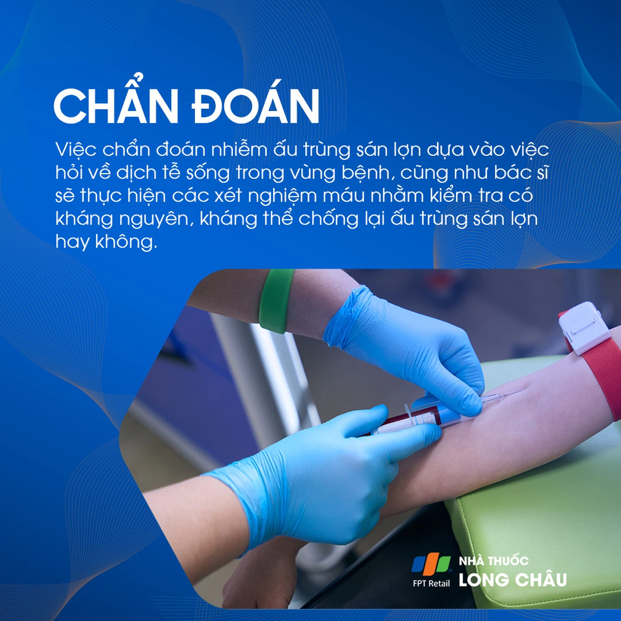 Nhiễm ấu trùng sán lợn 5