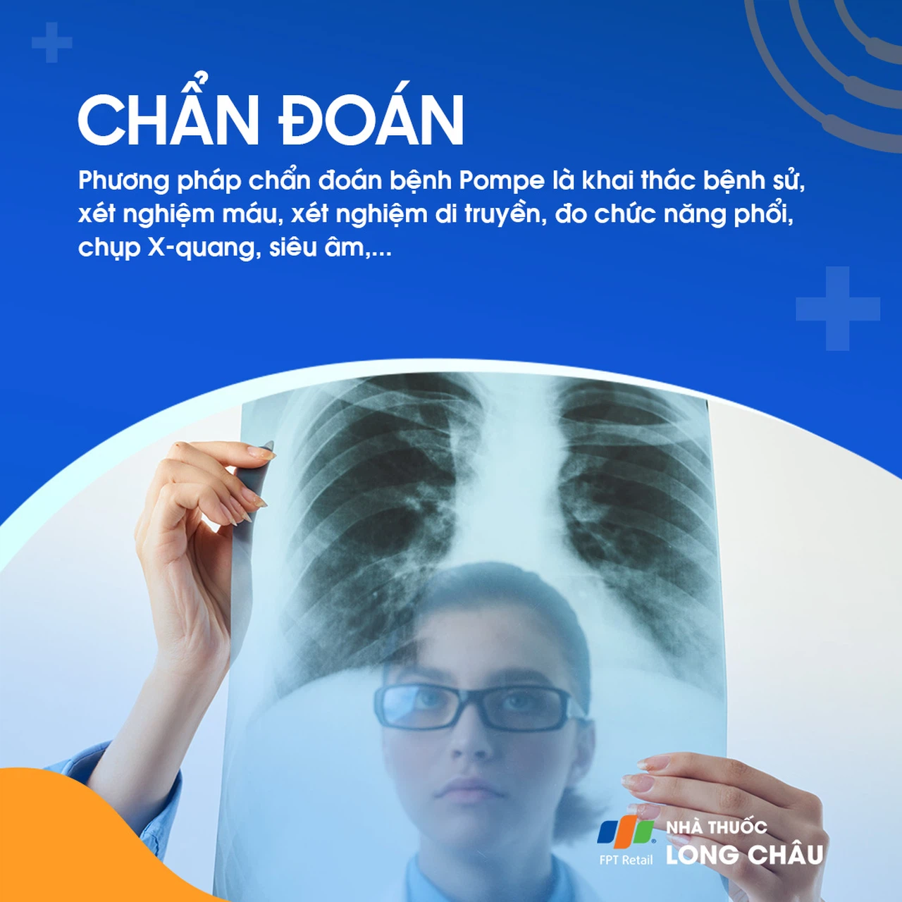 Bệnh pompe 6