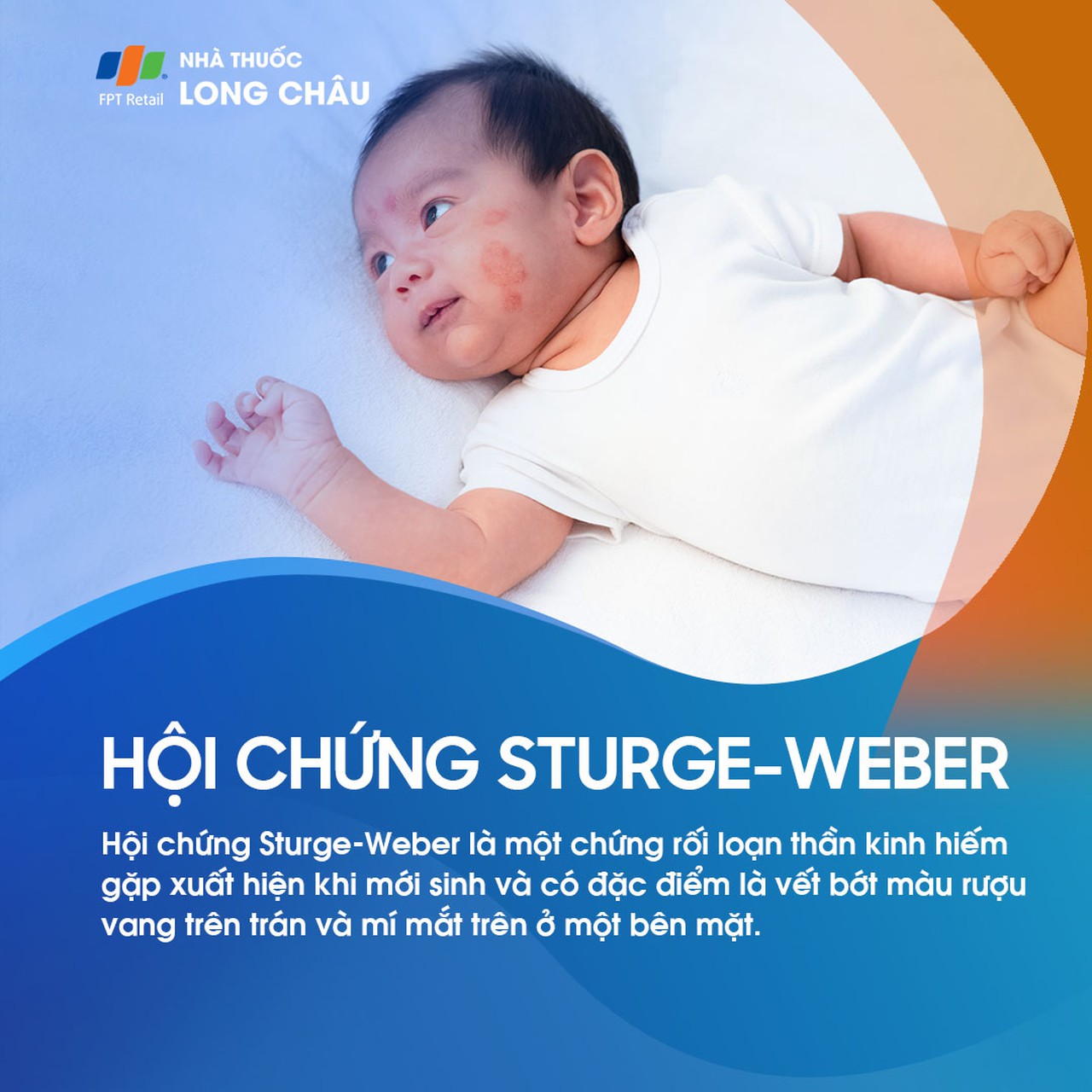 Sturge-Weber 1