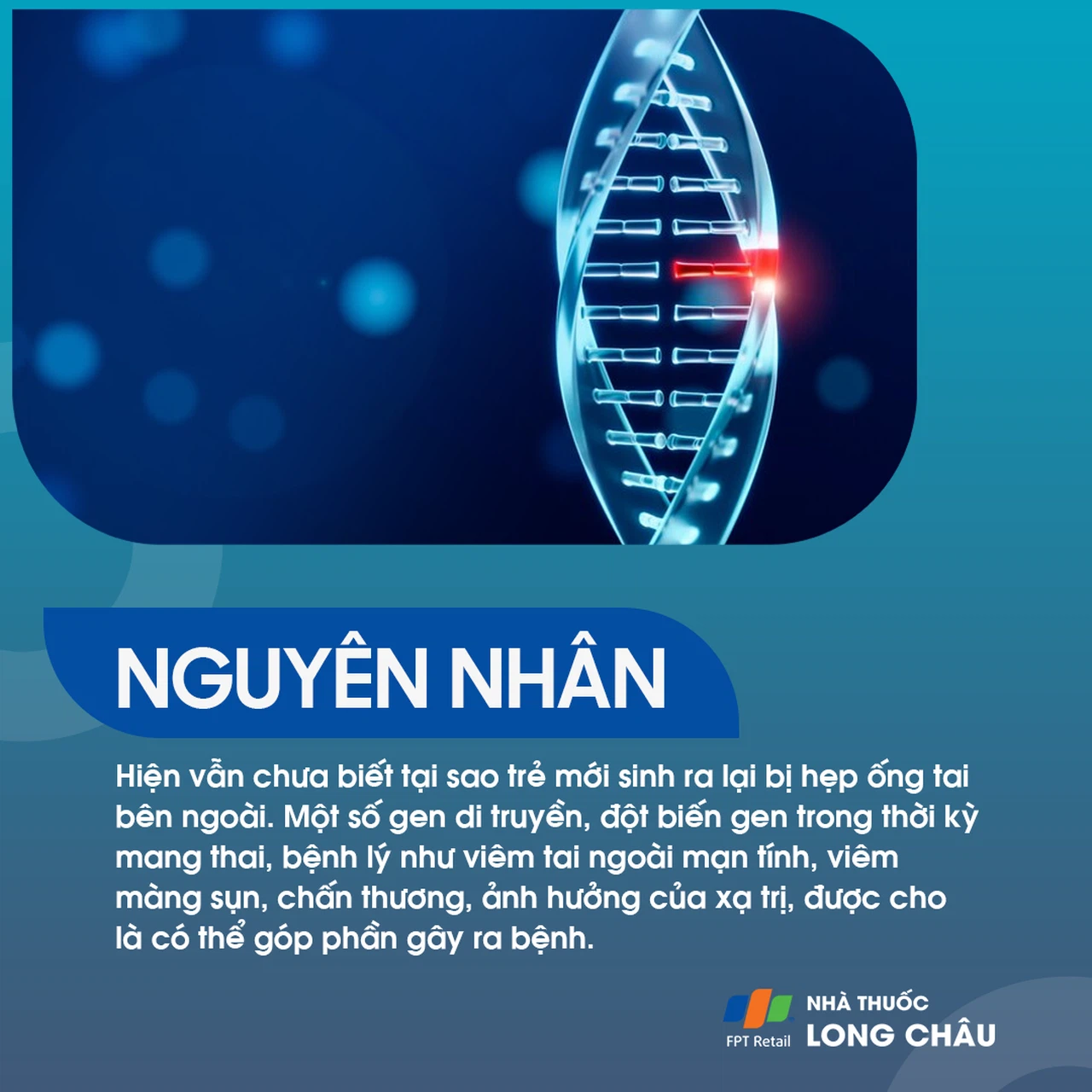 Hẹp ống tai bên ngoài 3