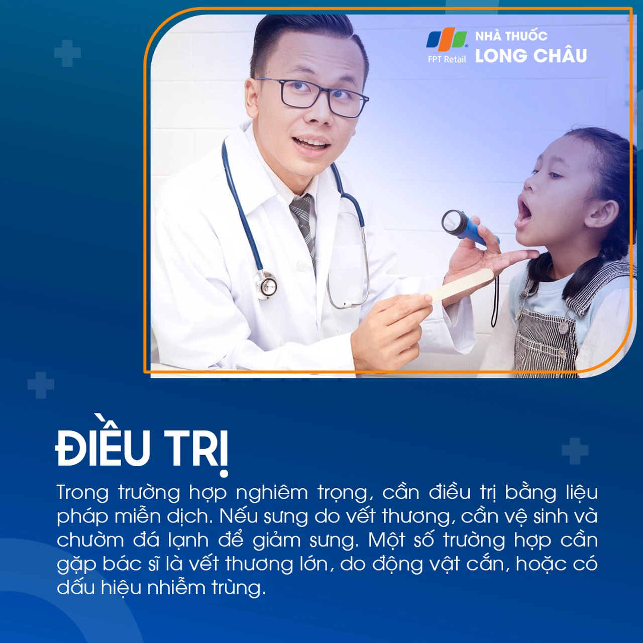 Sưng môi 7