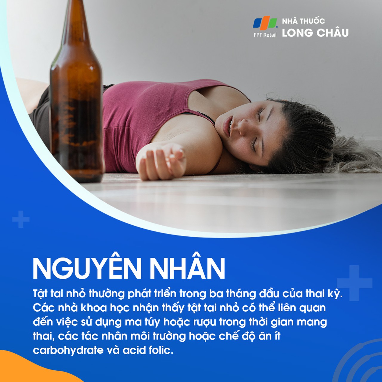 Tật tai nhỏ 3