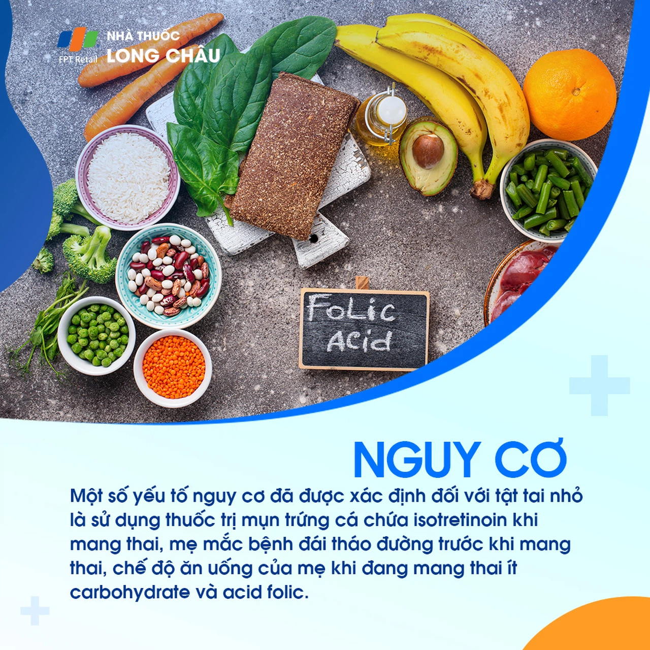 Tật tai nhỏ 4