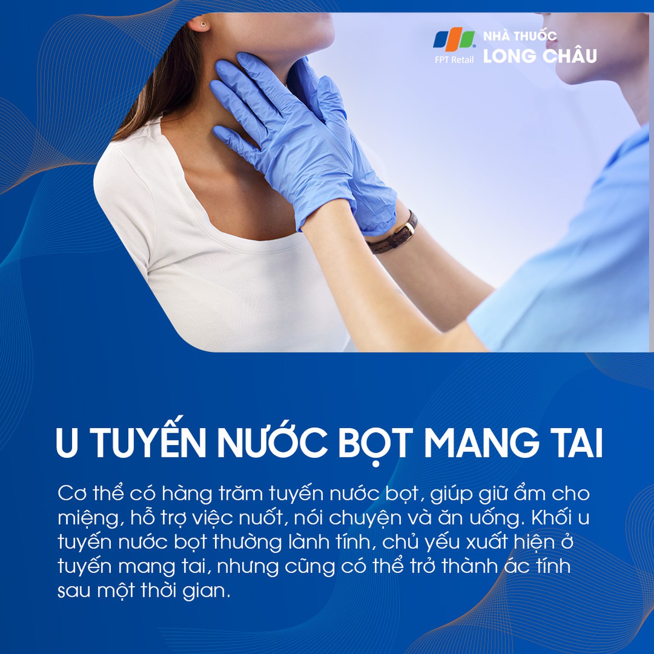 U tuyến nước bọt mang tai 1