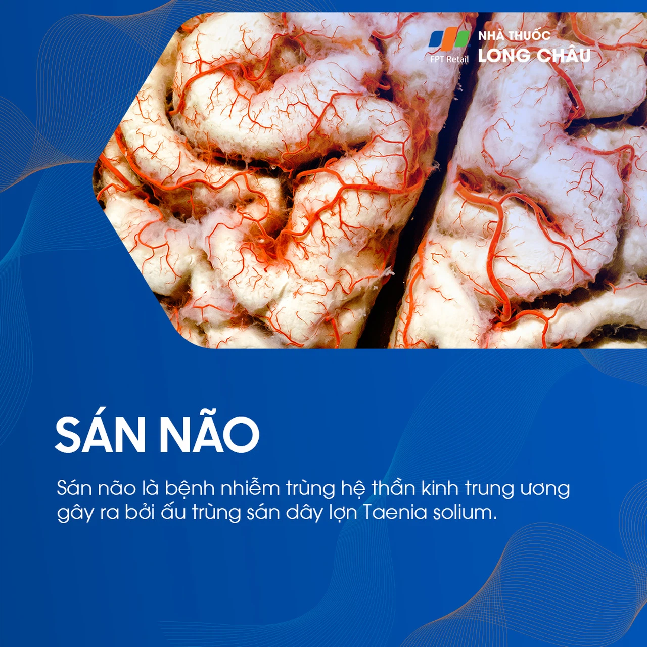 Sán não 1