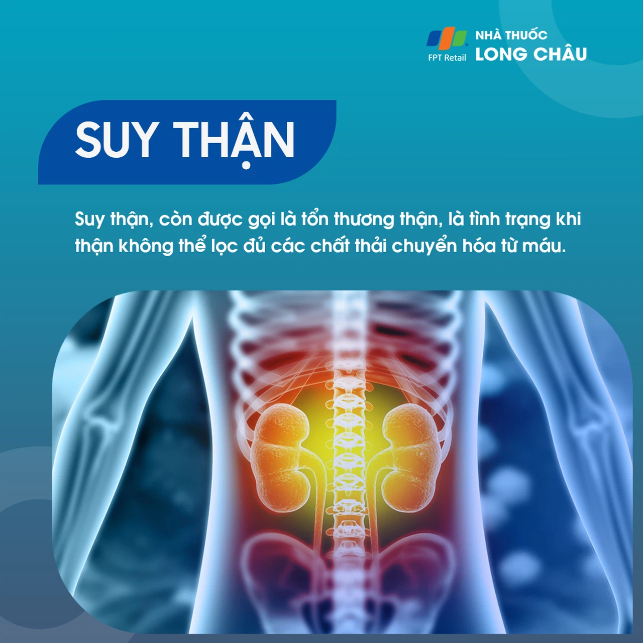 Suy thận hay còn gọi là tổn thương thận là tình trạng thận không có khả năng lọc đầy đủ