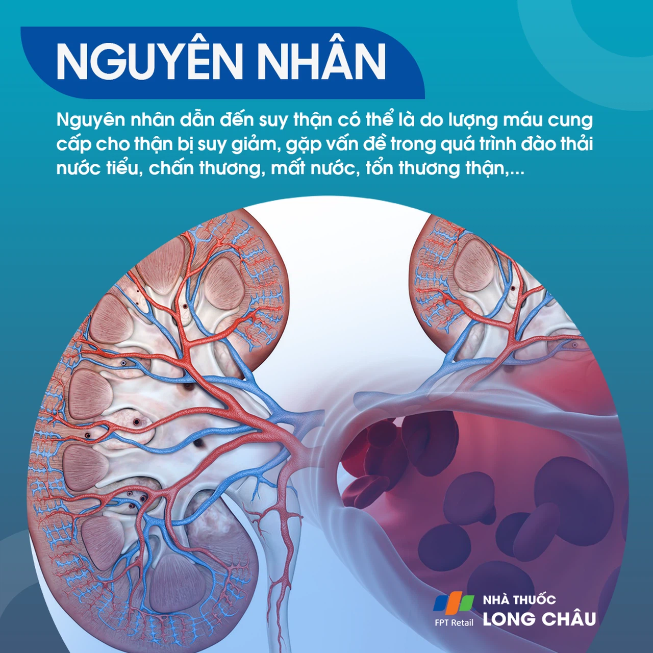 "Nguyên nhân suy thận - Các yếu tố gây tổn thương thận