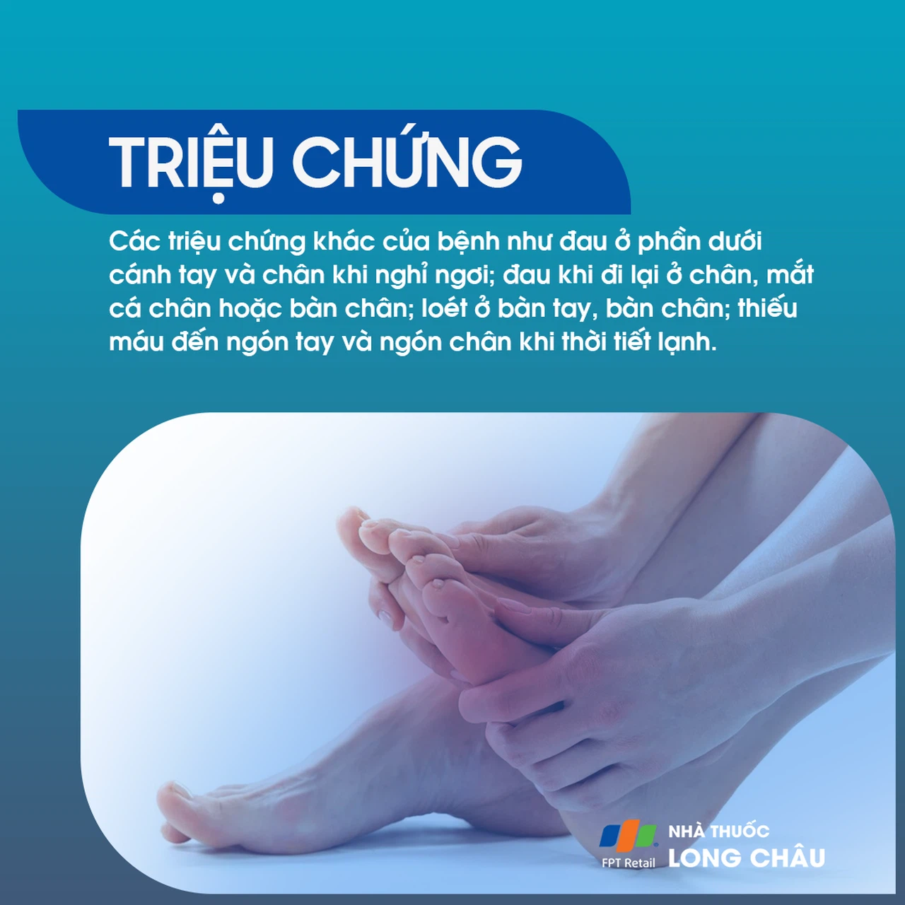 Bệnh Buerger 3