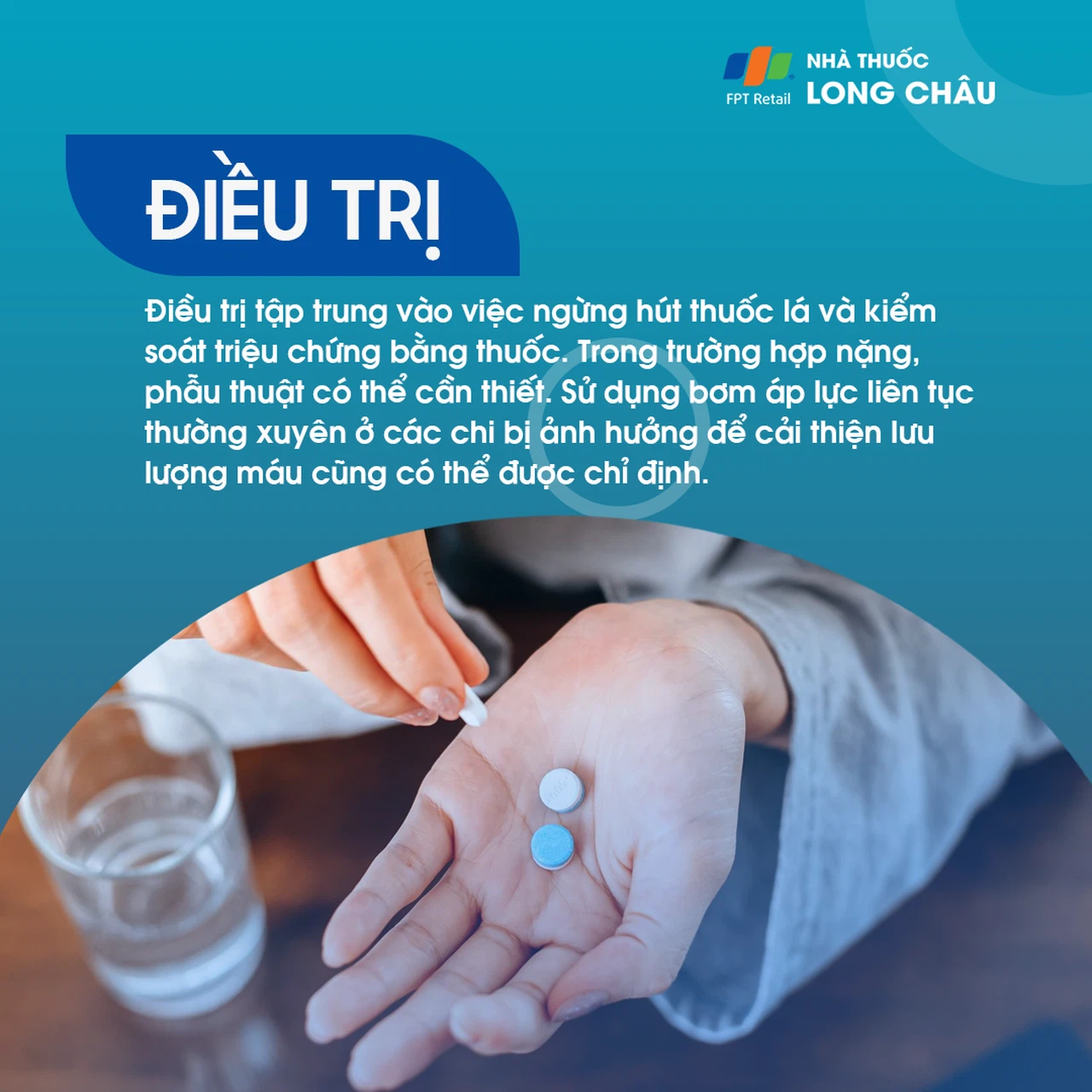 Bệnh Buerger 7