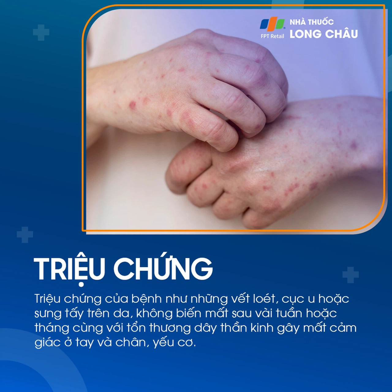 Phong 2
