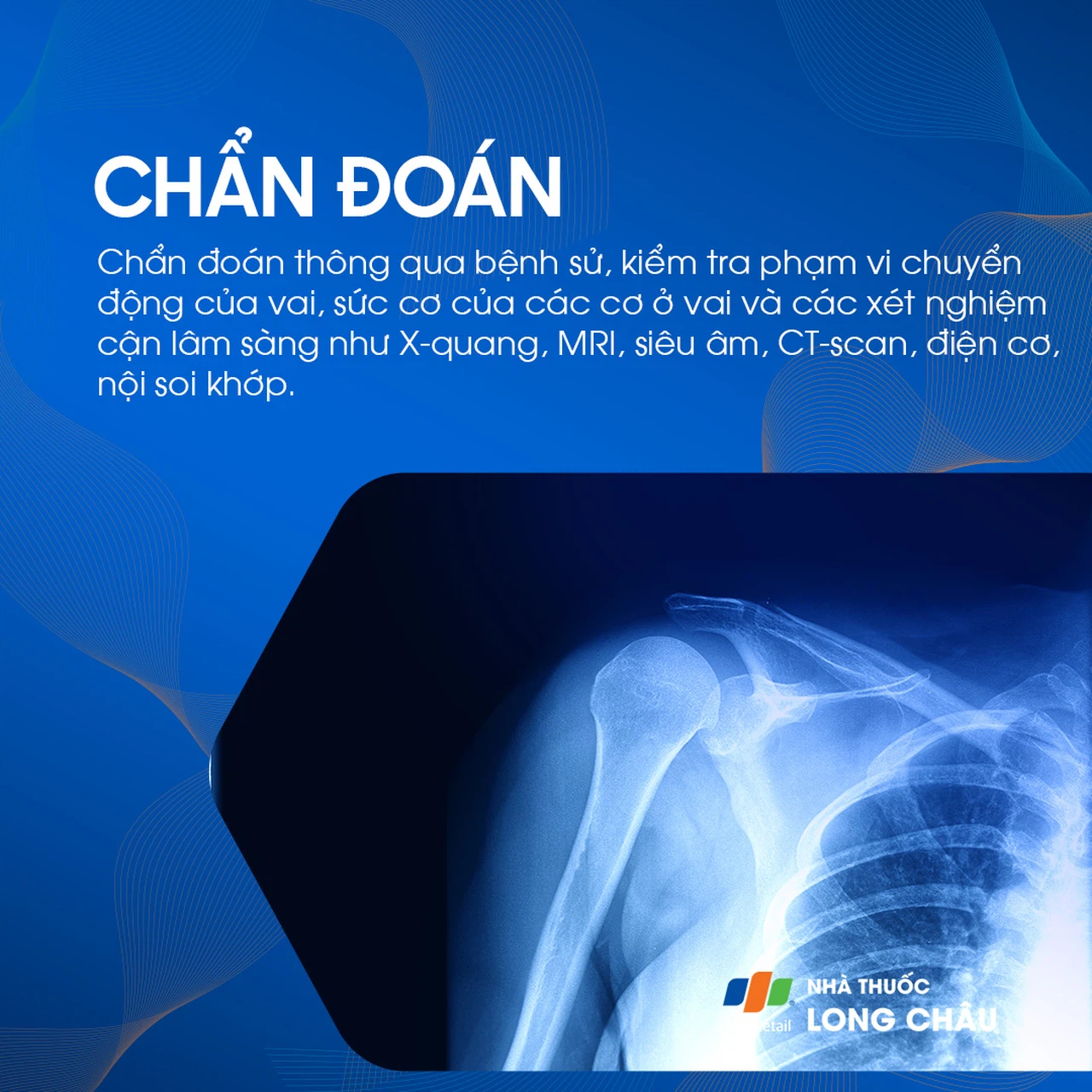 Đau bả vai 5